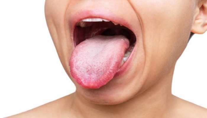 Tongue Colour: तुमची जीभ अशी दिसत असेल तर सावधान! जीभ कधी होते पांढरी, आरोग्याबाबत जाणून घ्या 