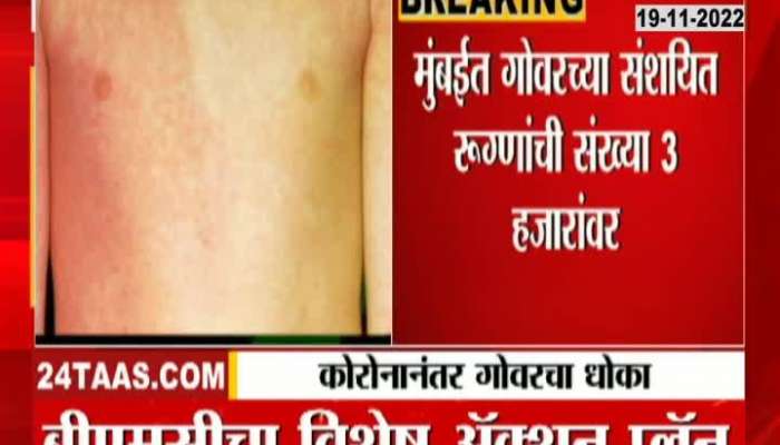Parents beware! Measles has raised concern in Mumbai, see this news