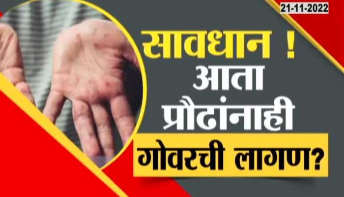 Adult Infected By Measles in Mumbai