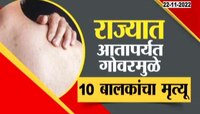 Measles, Rubella In Mumbai | धक्कादायक! राज्यात आत्तापर्यंत गोवरमुळे 'इतक्या' मुलांचा मृत्यू