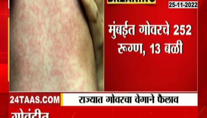 Beware! 4 crore children at risk of measles, see doctors tell how to take care