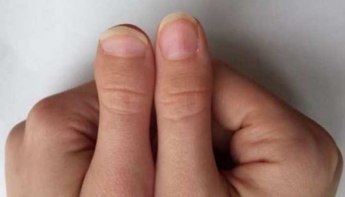 Thumb Palmistry : तुमच्या हाताचा अंगठाही उलगडतो मोठी रहस्य; कधी निरीक्षण केलंय का? 
