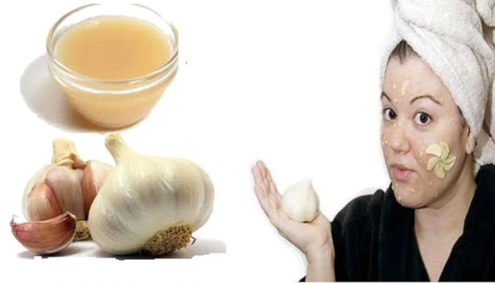 pimple remedy: पिंपल्स एका रात्रीत होतील गायब...नितळ त्वचेसाठी हे उपाय करून पाहाच... 