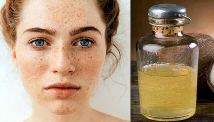 Skin Care: चेहऱ्यासाठी हे नैसर्गिक तेल खास अमृत, मुरुम आणि डाग होतील गायब