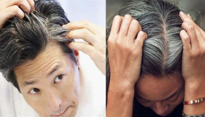 White Hair: ऐन तारुण्यात केस पांढरे होत आहेत? आजच &#039;या&#039; चार सवयी सोडा