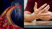 कोणत्या वयात किती असावी Cholesterol ची पातळी; जाणून घ्या एका क्लिकवर
