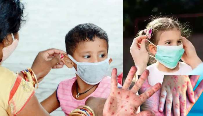 Measles Outbreak : गोवरचा धोका, &#039;या&#039; ठिकाणी मुलांना मास्क बंधनकारक!