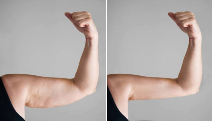 Arm Fat : हातांवरील अतिरिक्त चरबी कमी करायची असल्यास आजच करा &#039;हे&#039; व्यायाम