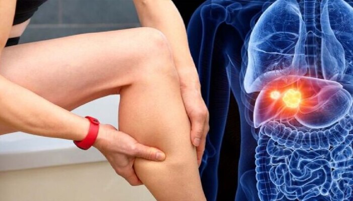 Liver disease symptoms: यकृत खराब झाल्यावर तुमच्या पायांमध्ये दिसून येतात &#039;हे&#039; बदल; वेळीच लक्षणं ओळखा