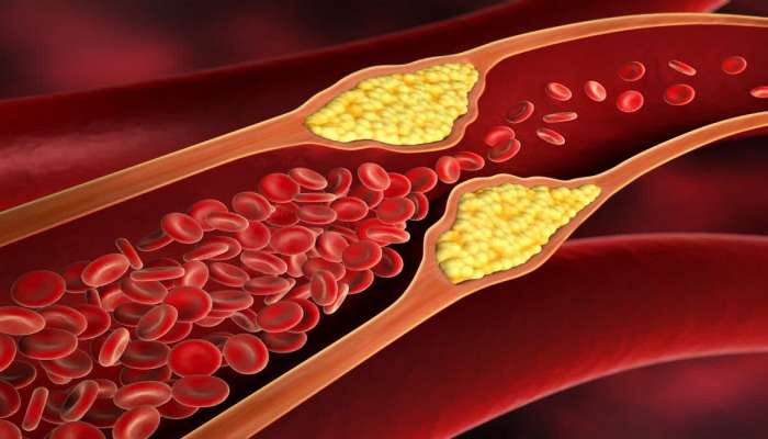  हिवाळ्यात &#039;हे&#039; 5 पदार्थ खा, Bad Cholesterol होईल दूर 