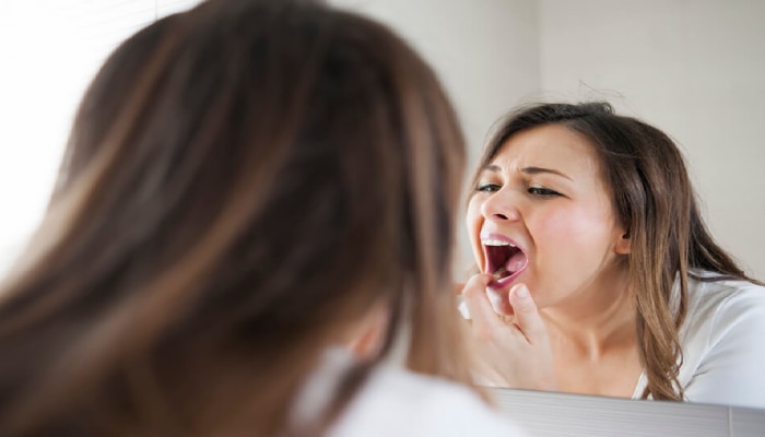 Dental plaque: दातांमध्ये जमा असलेला प्लाक कसा काढाल? &#039;या&#039; पद्धती करतील मदत