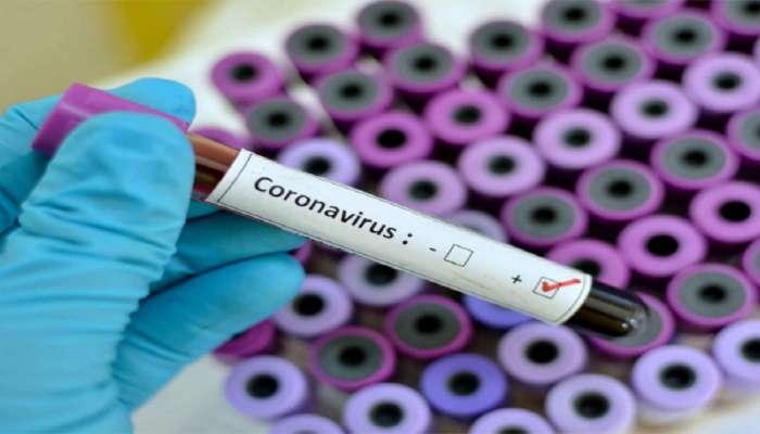 Coronavirus : 