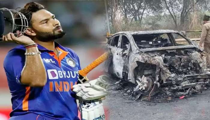 Rishabh Pant Car Accident : पाठीवर जखमा, पायाला गंभीर दुखापत…ऋषभ पंतच्या अपघाताचे फोटो पाहिले तर... 