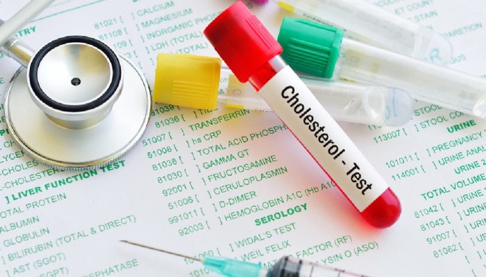 Cholesterol levels : वयोमानानुसार तुमची कोलेस्ट्रॉल लेवल किती असली पाहिजे? जाणून घ्या एका क्लिकवर