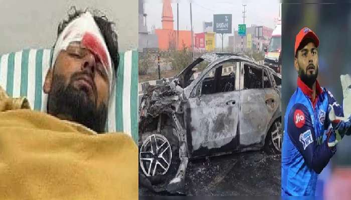 ऋषभ पंतच्या प्रकृतीबाबत मोठी बातमी, डॉक्टरांच्या 'या' माहितीमुळे क्रिकेट चाहत्यांना दिलासा