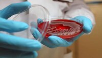 Superbugs : कोरोनानंतर आता सुपरबगमुळे धोका; शरीर संबंधातून होतोय संसर्ग