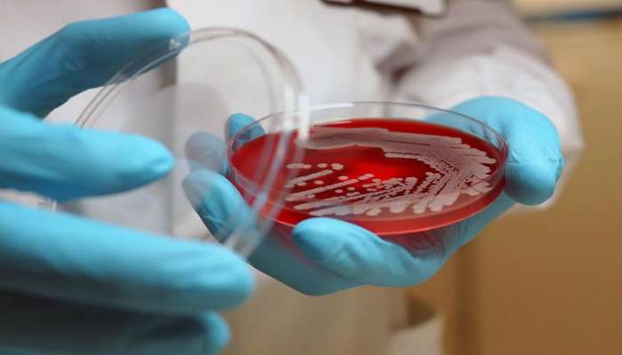 Superbugs : कोरोनानंतर आता सुपरबगमुळे मृत्यूचं तांडव होणार; शरीर संबंधातून होतोय संसर्ग