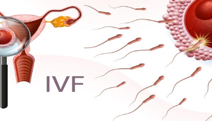 IVF Process :  वजन जास्त असलेल्या महिलांमध्ये IVF फेल होते ?...काय आहेत समज-गैरसमज
