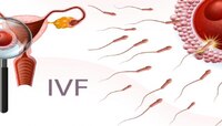 IVF Process : वजन जास्त असलेल्या महिलांमध्ये IVF फेल होते ?...काय आहेत समज-गैरसमज