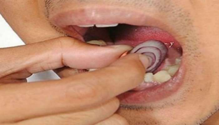 Tooth Ache remedies: दातदुखी की डोकेदुखी...असह्य वेदना कमी करणं आता शक्य...तेही घरगुती उपायांनी 