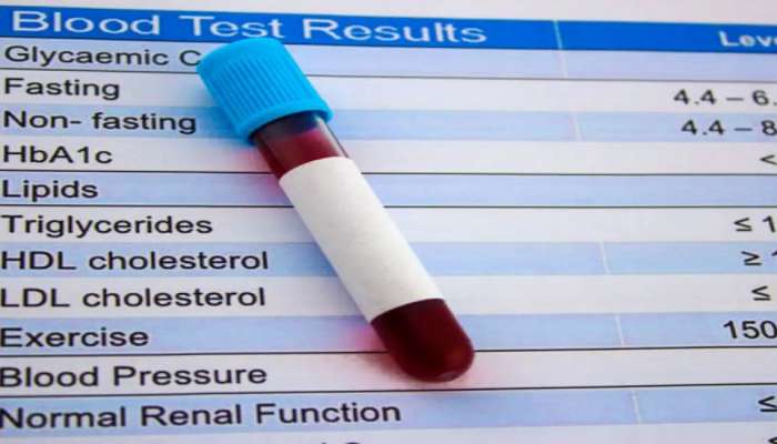 Cholestrol Level : तुमचं वय किती ? कोलेस्ट्रॉलची पातळी किती असायला हवी...जाणून घ्या सर्वकाही