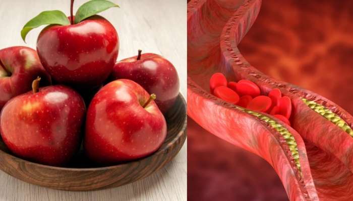 High Cholesterol: थंडीच्या दिवसात आहारात या फळांचा समावेश करा, वितळून जाईल नसांत जमा झालेले कोलेस्ट्रॉल 