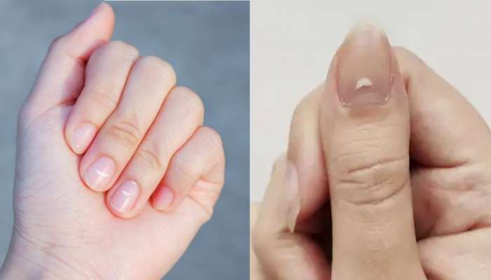White Spot on Nails: लकी ठरते नखावरील ही छोटी निशाणी, जीवनात धनसंपत्तीसह मिळते ऐश्वर्य
