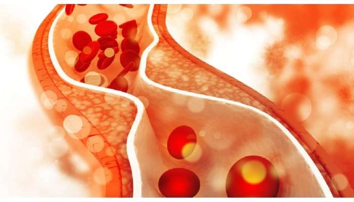 Cholesterol Level By Age : कोणत्या वयात किती हवं तुमचं कोलेस्टेरॉल...आताच जाणून घ्या...