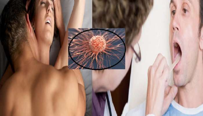 Mouth Cancer : धक्कादायक! Oral Sex मुळे तोंडाच्या कॅन्सरच्या प्रमाणात वाढ ? पाहा काय म्हणाले एक्सपर्ट्स....