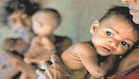 Adenoviruses : पालकांचे टेन्शन वाढवणारी बातमी;  Adenoviruses चे थैमान