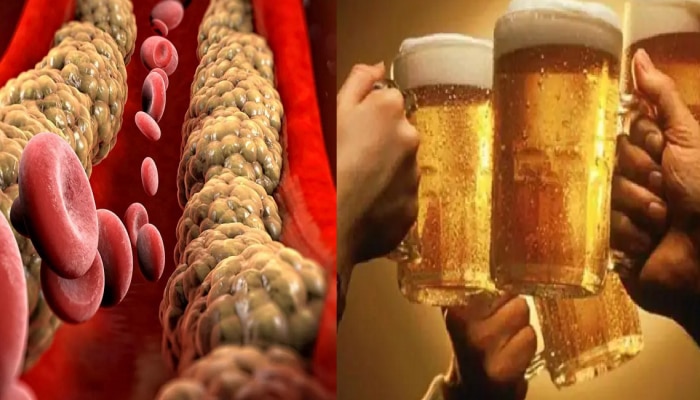 Cholesterol :  Beer प्यायलामुळे खरंच कोलेस्ट्रॉल कमी होतं? जाणून घ्या काय सांगतात तज्ज्ञ