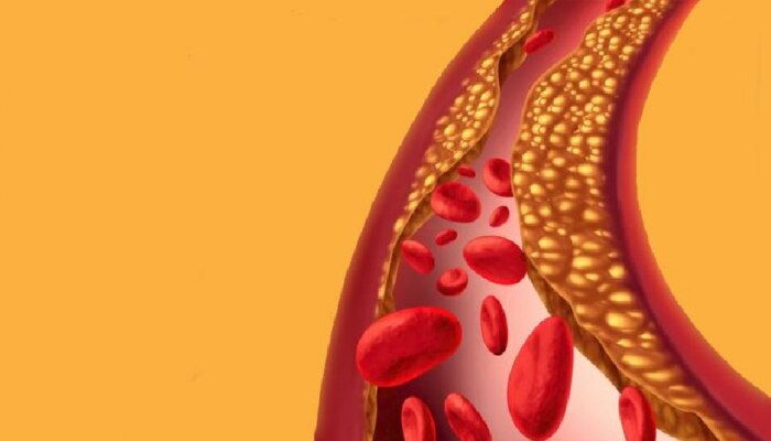 Lower cholesterol : शरीरातील Cholesterol कमी करतील किचनमधील &#039;या&#039; गोष्टी!