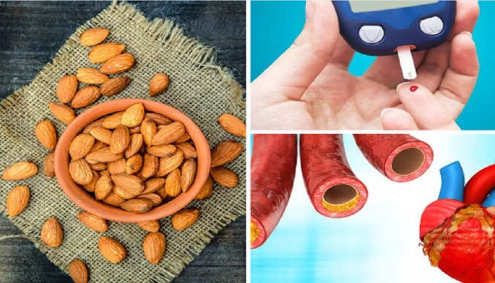 Almonds : बदाम हा Cholesterol - Diabetes चा शत्रू, एम्सच्या डॉ. ने सांगितले 5 जबरदस्त फायदे