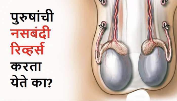 Reverse Vasectomy: पुरुषांची नसबंदी रिव्हर्स करता येते का? पुन्हा वडील होण्याचं सुख मिळू शकतं का?