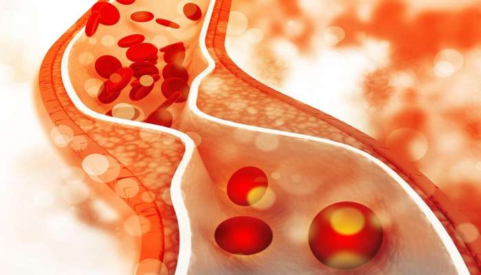 High cholesterol कमी करण्यासाठी आहारात करा &#039;या&#039; गोष्टींचा समावेश