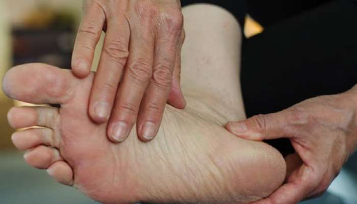 Diabetes Feet Symptoms : रक्तातील साखर वाढल्यावर सर्वात आधी पायात दिसतात हे बदल 