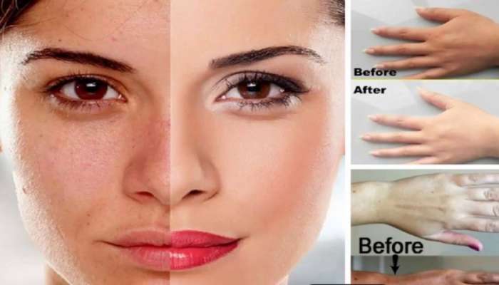 Glowing Skin Tips : स्किन ड्राय आणि टॅन झालेय ? 7 दिवसात काचेसारखी चमकेल; वापरा हे घरगुती उपाय 