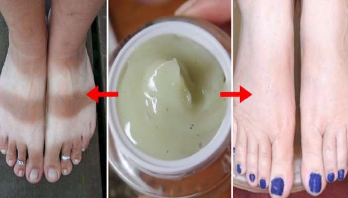 Pedicure At Home: पार्लरसारखं पेडिक्युअर करा फक्त 10 रुपयांत तेही घरच्या घरी...