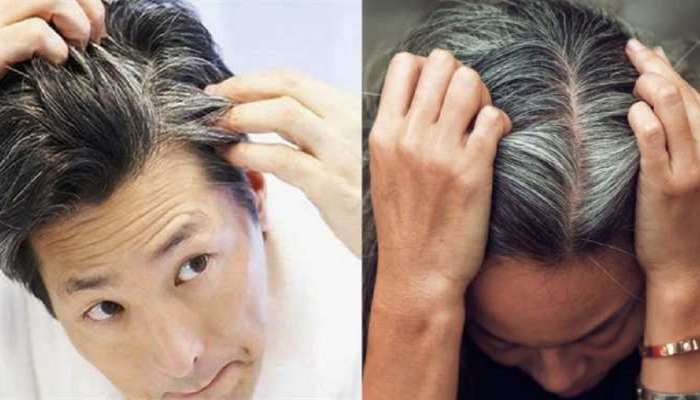 White Hair Problem: तरुणपणातच केस पांढरे होतायत का? जाणून घ्या कारणं आणि त्यावरील उपाय