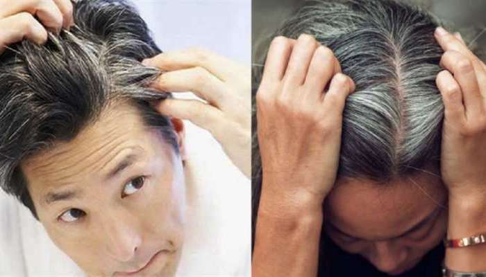 White Hair Problem: तरुणपणातच केस पांढरे होतायत का? जाणून घ्या कारणं आणि  त्यावरील उपाय | White Hair Problem What are the reasons of white hairs in  young age and solutions