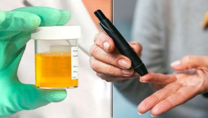 Diabetes symptoms : लघवीचा हा रंग असू शकतो मधुमेहाचा इशारा...आताच जाणून घ्या 
