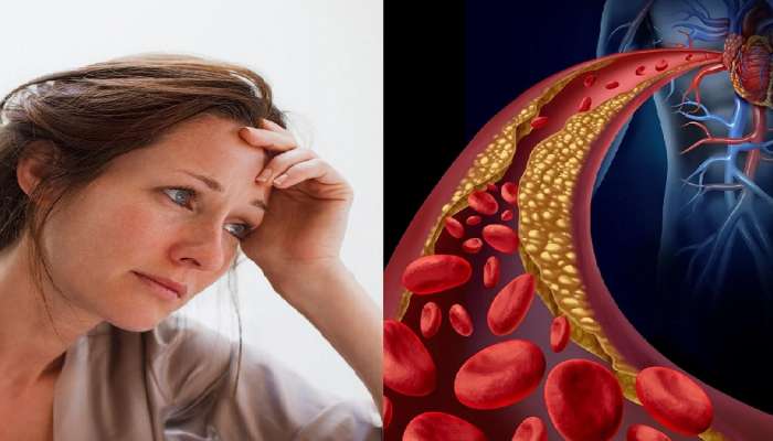 Cholesterol Level in Women : महिलांमध्ये उच्च कोलेस्टेरॉलची लेव्हल कशी ओळखाल?