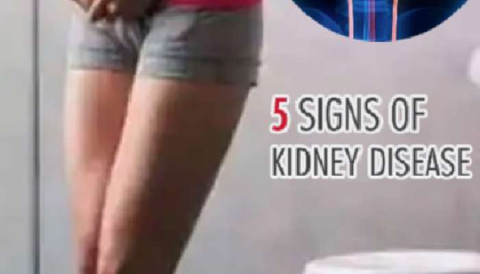 kidney problem symptoms