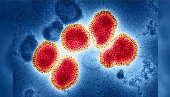 H3N2 Cases in Maharashtra: काळजी घ्या...राज्यात दोघांचा मृत्यू तर 119 जणांना लागण