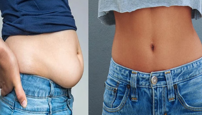 Belly Fat: &#039;या&#039; 5 स्टेप्स करा फॉलो; वाढलेल्या पोटाचा घेर नक्की होईल कमी!