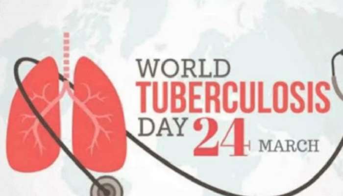 World Tuberculosis Day 2023: जागतिक क्षयरोग दिन 24 मार्चलाच का साजरा केला जातो? यंदाची World TB Day ची थीम काय?