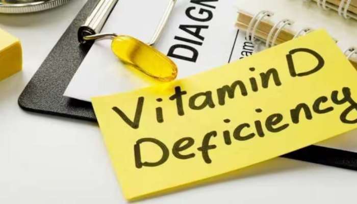 Vitamin Deficiency : व्हिटामीनची कमी झाल्यास होईल शरीरावर वाईट परिणाम, लगेचच बदला तुमचं डायटं