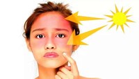 Remove Summer Tan: उन्हामुळे त्वचा झाली टॅन? तर करा 'हे' उपाय