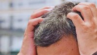 White Hair: आता पांढऱ्या केसांपासून कायमची सुटका? अखेर उपाय मिळाला!