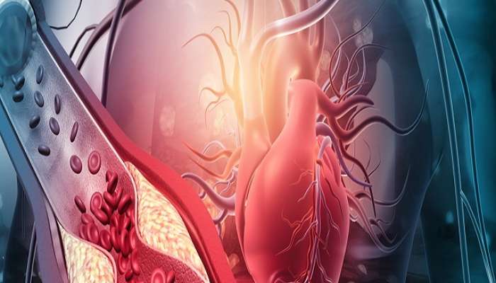 Cholesterol: कोलेस्ट्रॉल कमी करण्यासाठी बेस्ट उपाय 